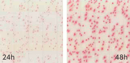 MC-Media Pad ACplus Coloring sample: Gram-negative bacteria