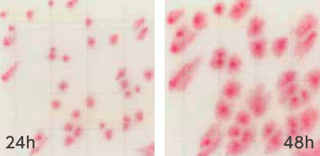 MC-Media Pad ACplus Coloring sample: Gram-positive bacteria