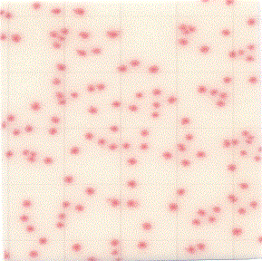 MC-Media Pad Aerobic Count Coloring sample: E. coli
