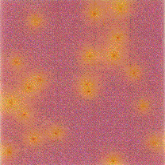 MC-Media Pad EB Coloring sample： for Enterobacteriaceae