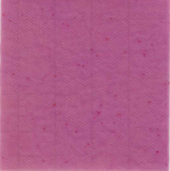 MC-Media Pad EB Coloring sample： for Enterobacteriaceae